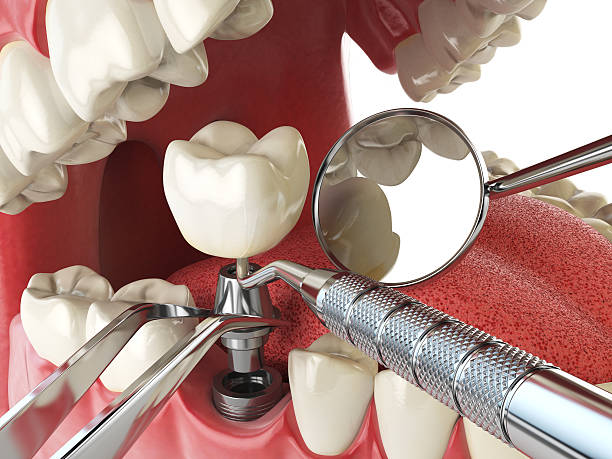 Best Walk-In Emergency Dentist in Valley Cottage, NY